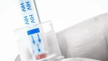 Tercer caso en el mundo de curación del VIH luego de un trasplante de células madre