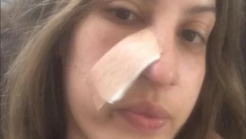 Tiene 27 años y descubrió que tenía cáncer por una limpieza facial Tiene 27 años y descubrió que tenía cáncer por una limpieza facial
