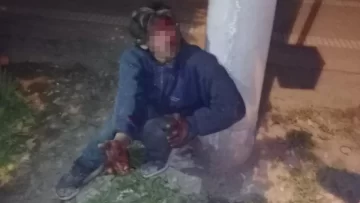 Un barrio de Tucumán quedó sin luz debido a un ladrón que intentaba robar los cables de la zona Un barrio de Tucumán quedó sin luz debido a un ladrón que intentaba robar los cables de la zona