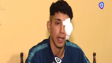 Violencia en un boliche en Tucumán: joven salió a bailar y recibió un balazo de goma en uno de sus ojos Violencia en un boliche en Tucumán: joven salió a bailar y recibió un balazo de goma en uno de sus ojos