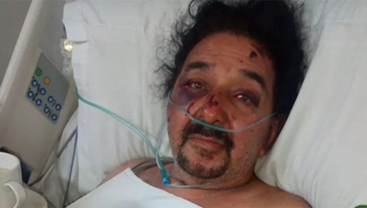 Delincuentes asaltaron violentamente a un comerciante en Burruyacú Delincuentes asaltaron violentamente a un comerciante en Burruyacú