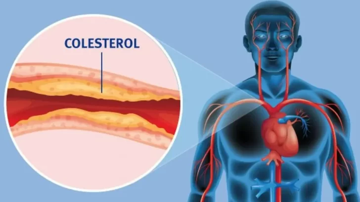 Lanzaron un medicamento para bajar el colesterol hecho en Argentina