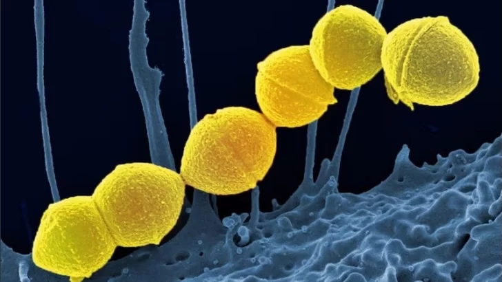 Alerta en Argentina por el aumento de casos por la bacteria streptococcus pyogenes