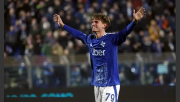 Scaloni sigue de cerca la lesión de Nico Paz Scaloni sigue de cerca la lesión de Nico Paz