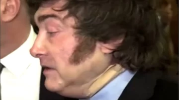La razón por la que el presidente Milei usó un vendaje en el cuello La razón por la que el presidente Milei usó un vendaje en el cuello